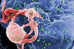 فيروس الأيدز وخلية لمفاوية